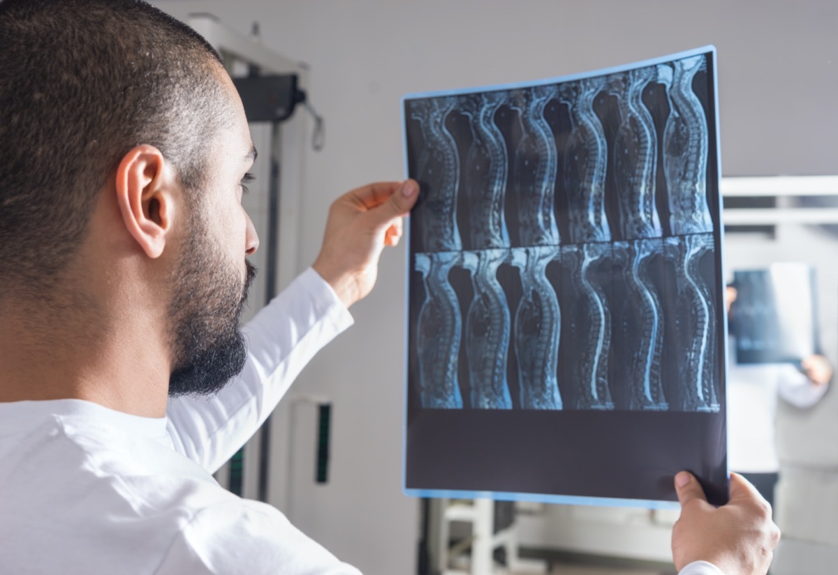 Radiologist analysing X-ray image with human spine in consulting room