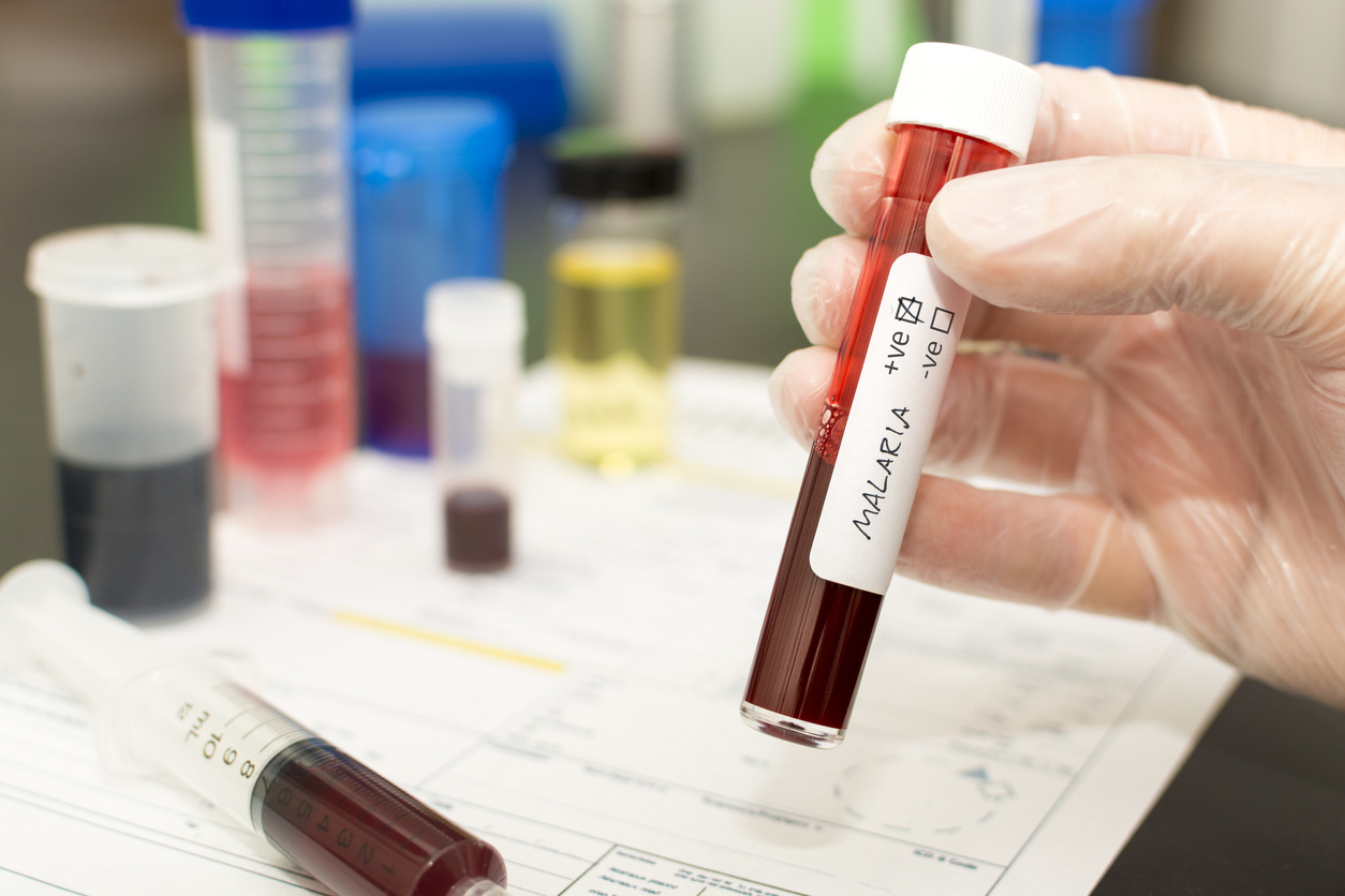 A close up of a hand holding a test tube with a blood sample that's positive for malaria