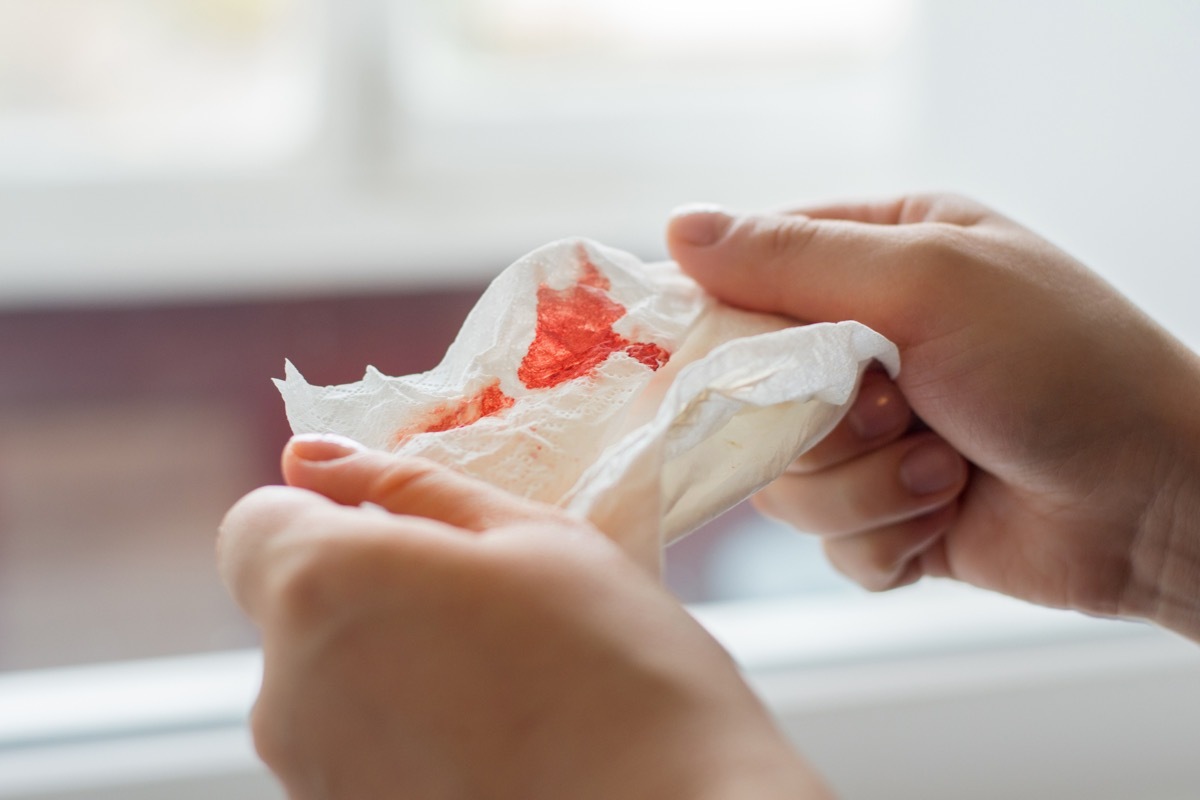 Photo of hands holding a napkin with blood