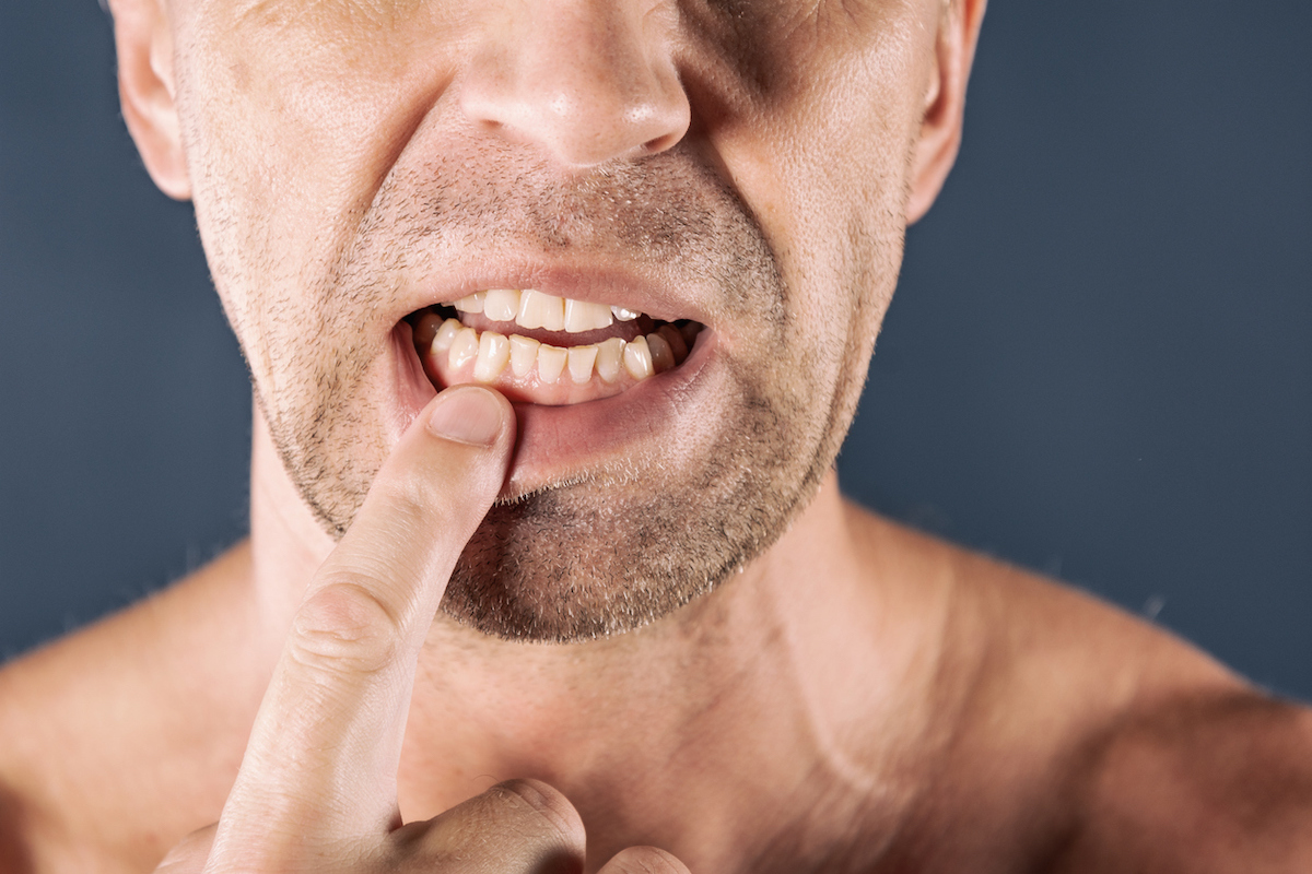 man in pain holding his gum.