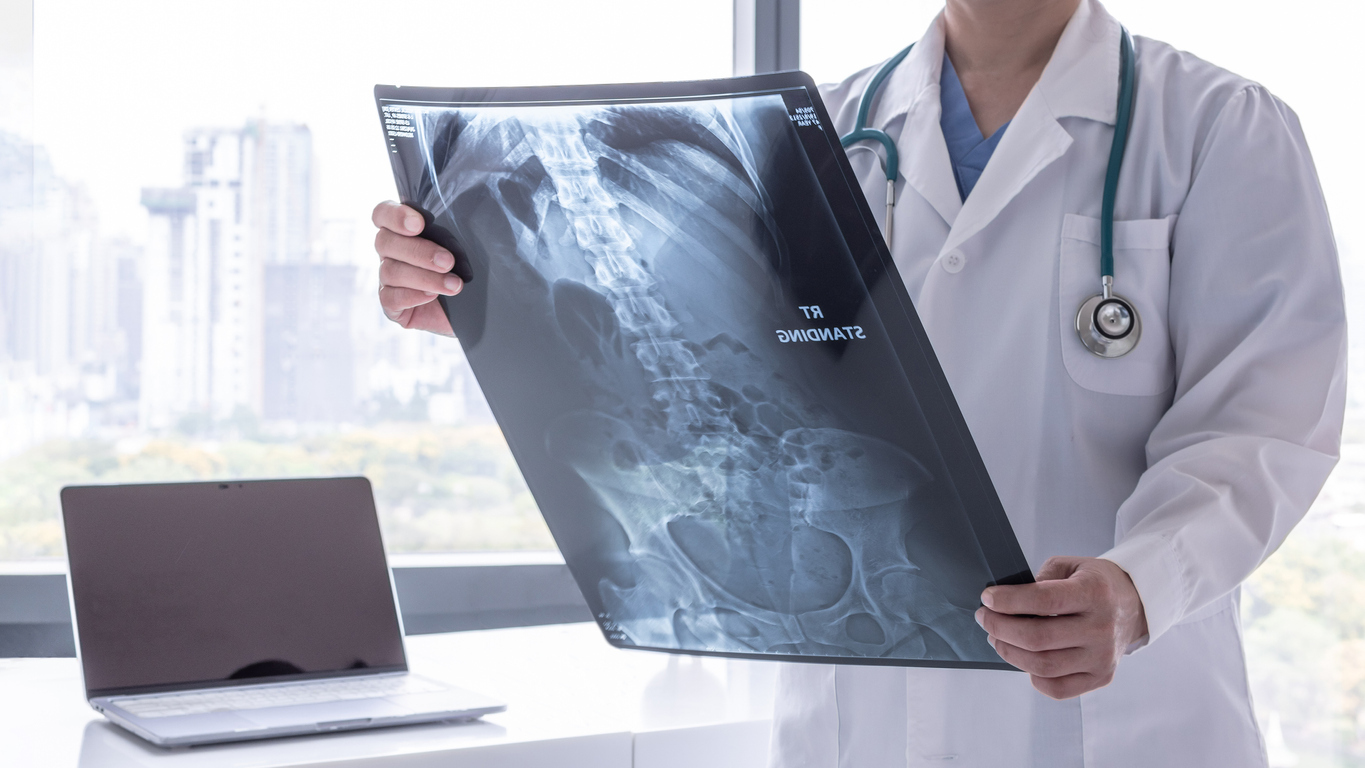 Doctor looking at an x-ray.